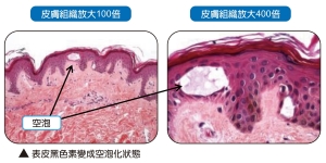 空泡效應